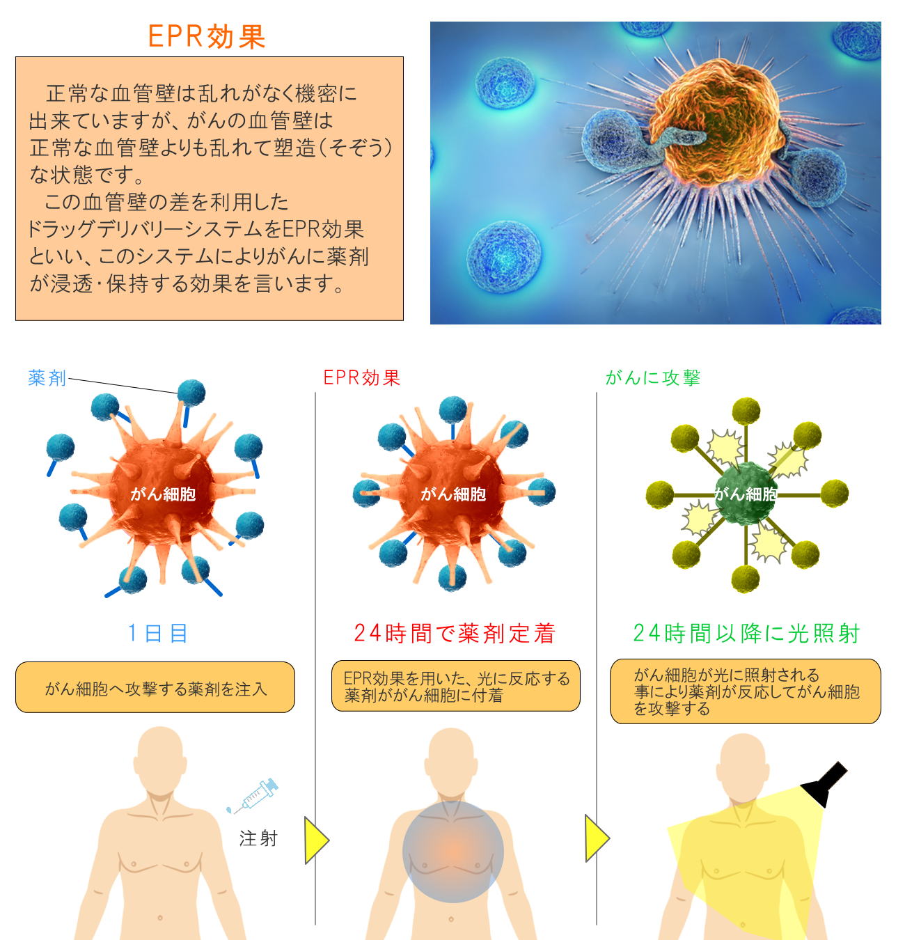 茨城でがん治相談療をお考えの方 | 光免疫療法導入TGC東京がんクリニック