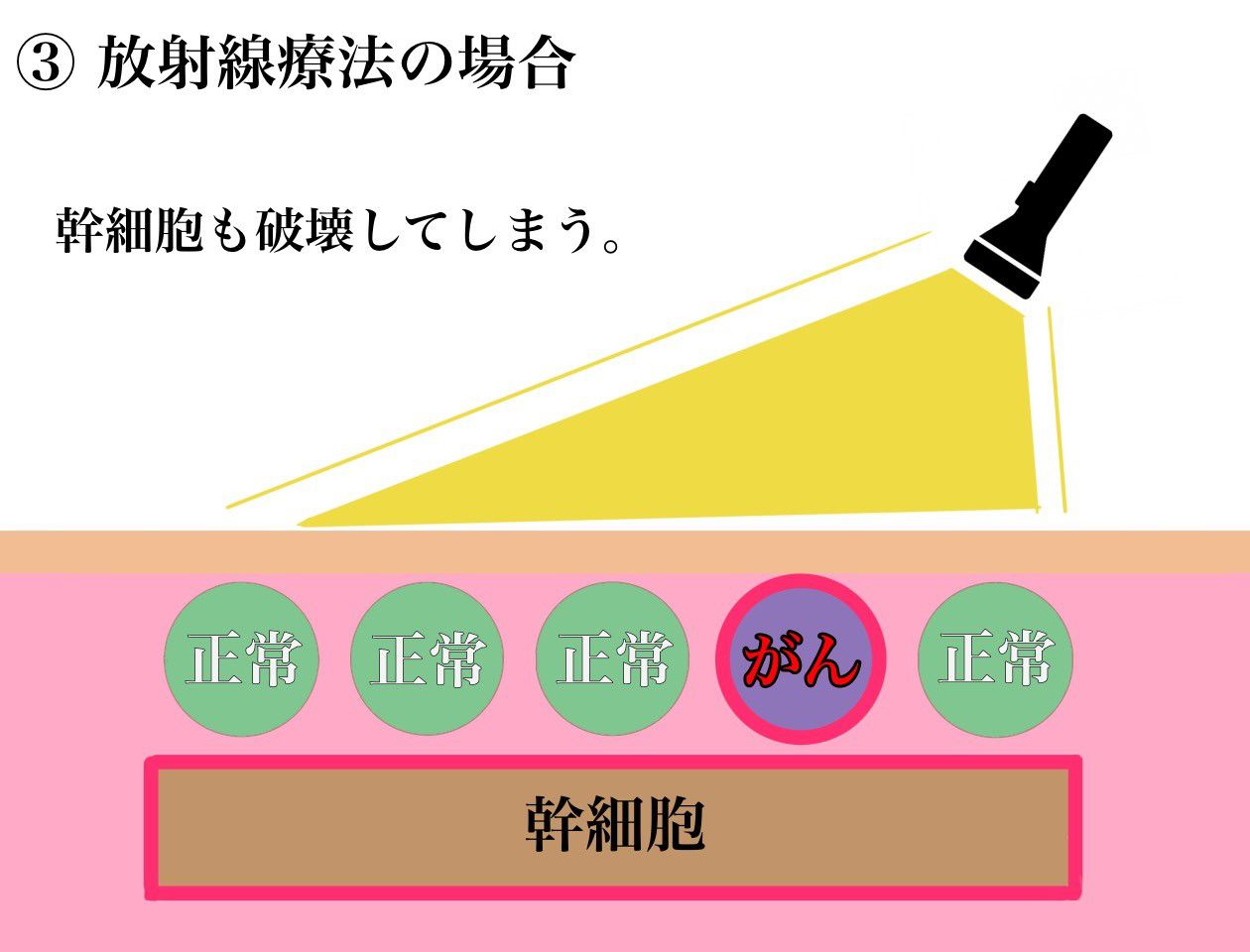 ③放射線療法