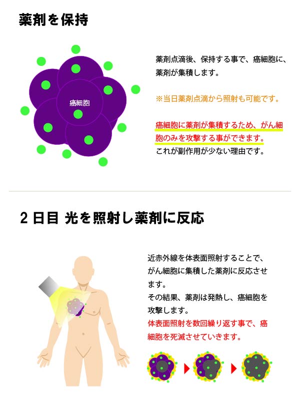 光療法