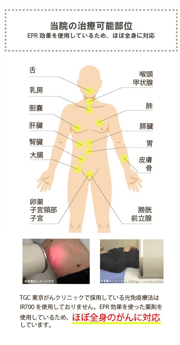 治療可能部位