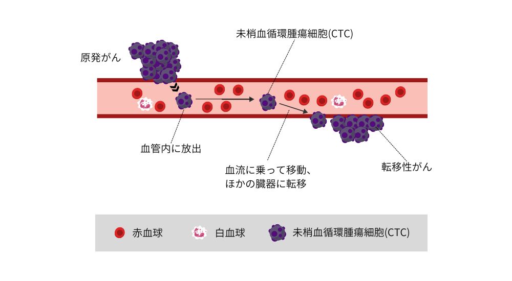 CTC検査とは