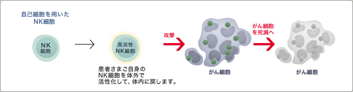 NK細胞療法の特徴