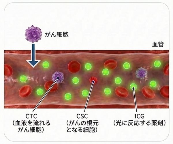 血管内に存在するがん細胞（CTC・CSC）とICG