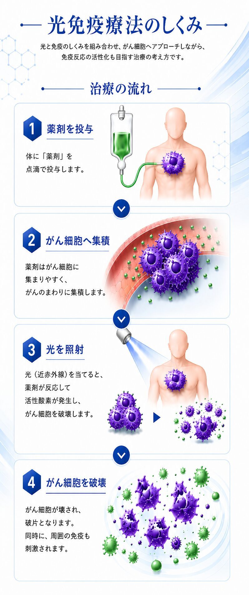 光免疫療法の点滴投与・がん細胞への集積・光照射・破壊の流れ