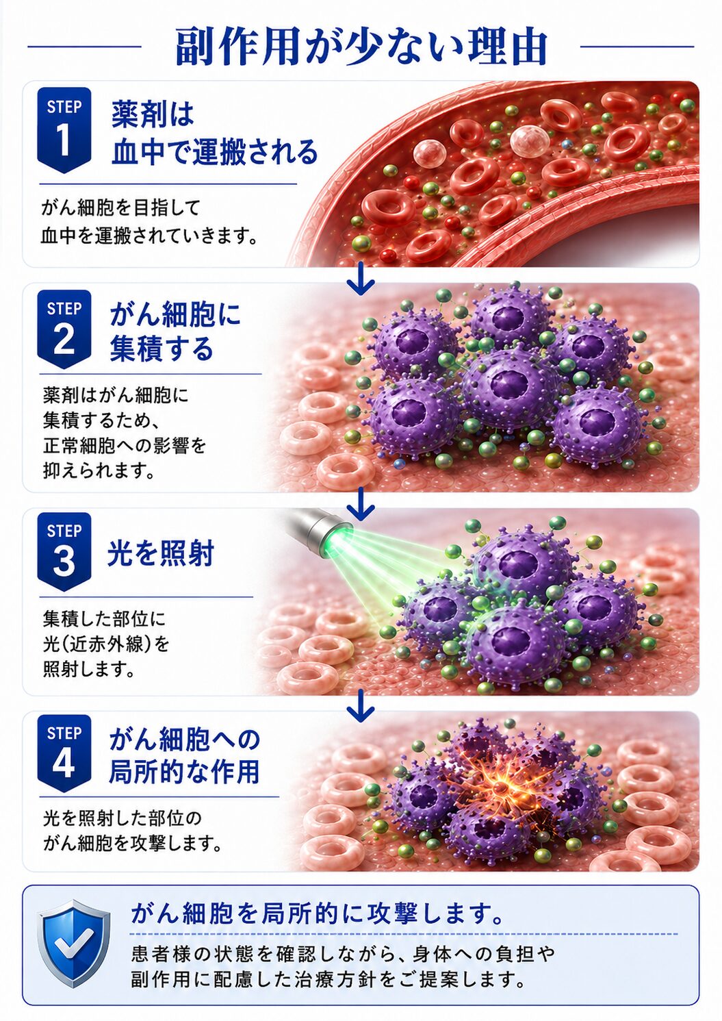 光免疫療法ががん細胞を局所的に攻撃する仕組み
