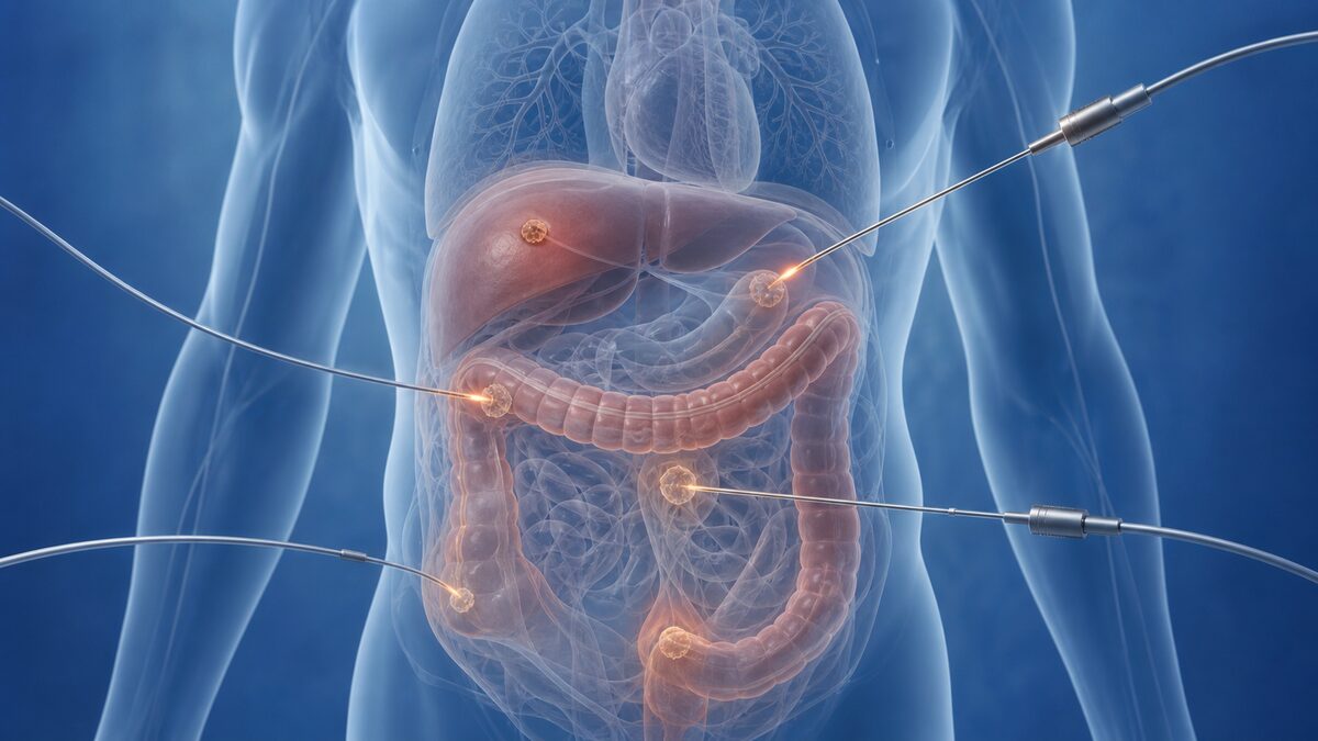 大腸や肝臓などの病変と治療方針を画像検査で確認するイメージ
