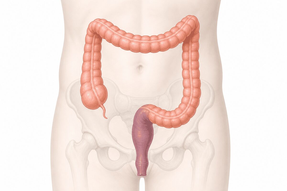 大腸の中で直腸が位置する場所を示す医療模式図